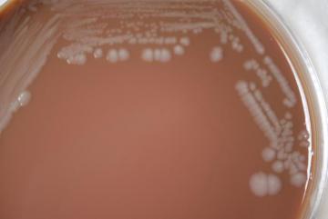 Burkholderia pseudomallei (image by CDC)