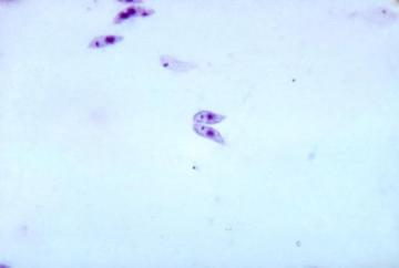 Leishmania donovani (credit: CDC) Leishmania donovani (credit: CDC)
