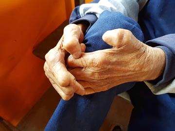 Limb damage caused by leprosy Limb damage caused by leprosy