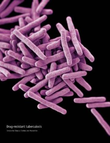 Drug resistant tuberculosis (credit: CDC)