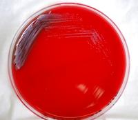 Burkholderia pseudomallei on blood agar plate (credit: CDC)