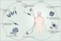 Leishmaniasis Leishmaniasis