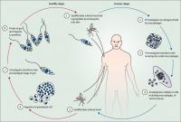 Leishmaniasis