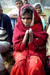 Leprosy sufferer, Munger Leper Colony India