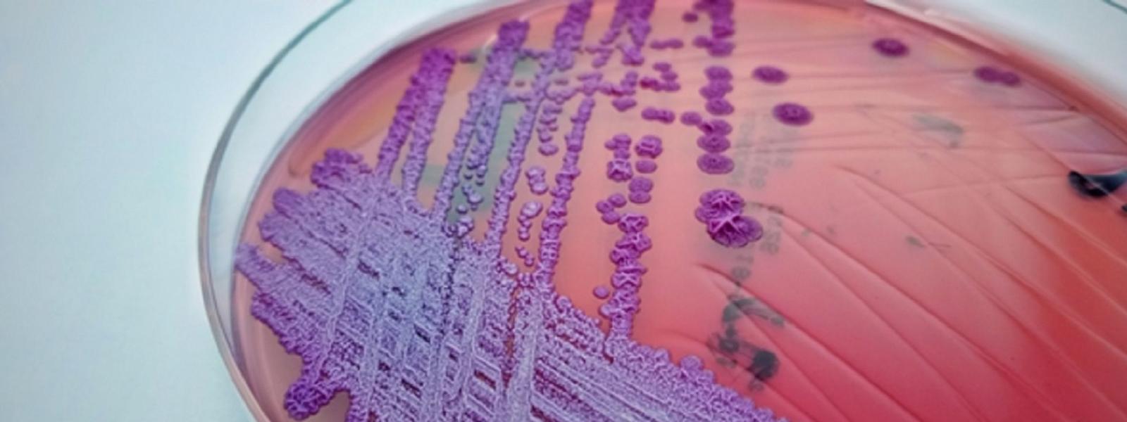Burkholderia pseudomallei banner burkholderia pseudomallei banner