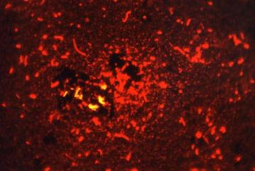 Fluorescent acid-fast stained smithwick photomicrograph of Mycobacterium tuberculosis