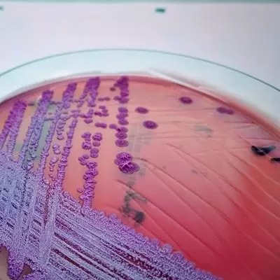 burkholderia pseudomallei