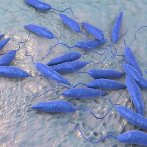 Leishmaniasis