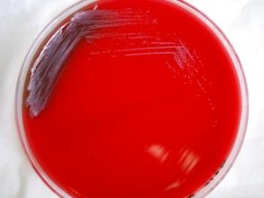 Burkholderia pseudomallei on blood agar plate (credit: CDC)