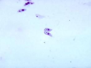 Leishmania donovani (credit: CDC)